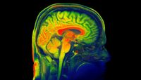 Mind Research Network and UNM Introduce ‘Brain Safe’ Project to Understand and Minimize Concussions on NCAA Athletes