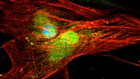 Exercise hormone may factor in breast cancer prevention
