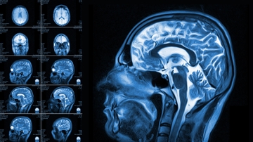 Medical physics master’s degree program seeking applicants for fall 2019