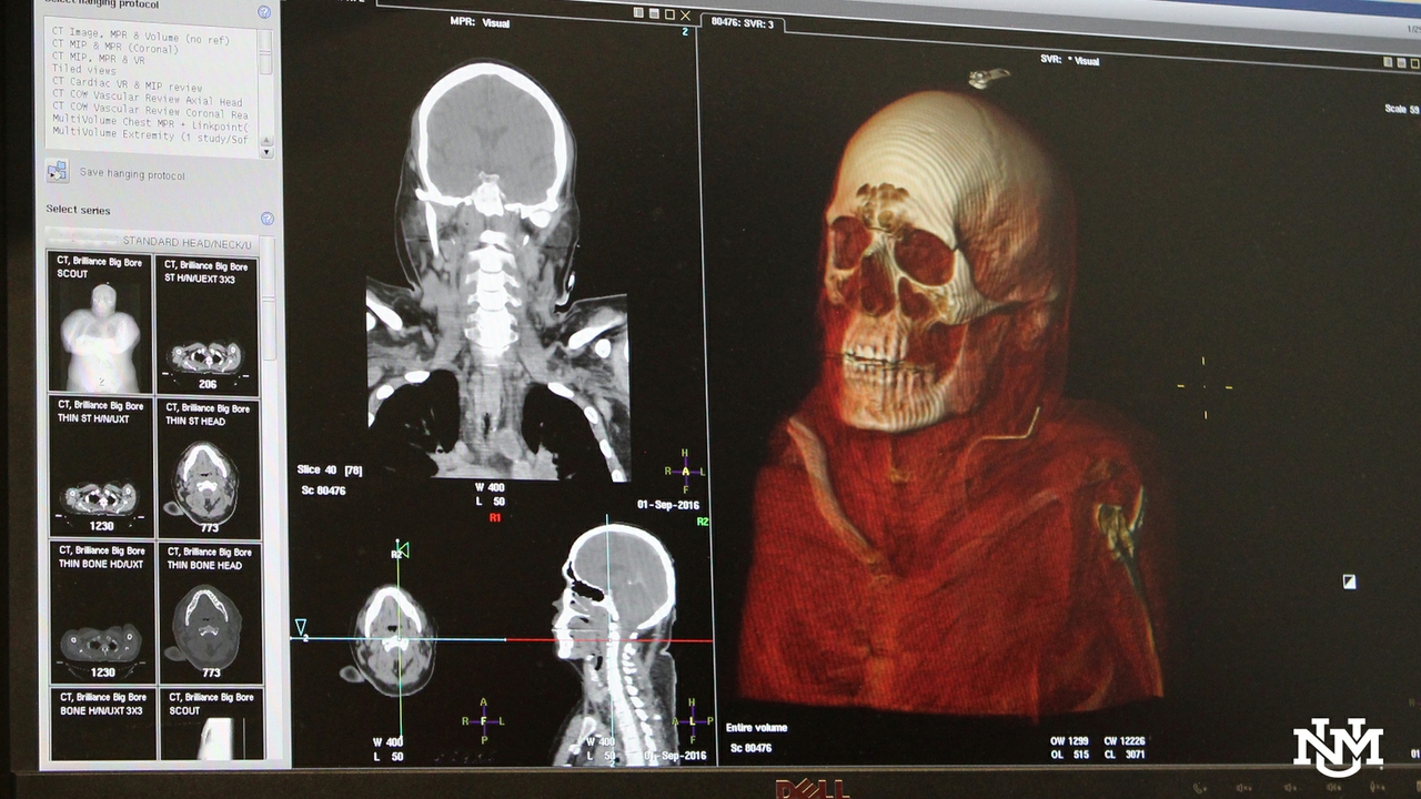 Skull scan