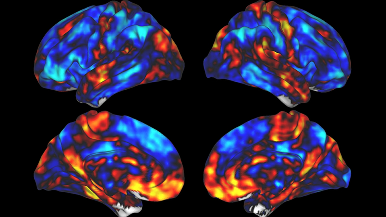 Brain images