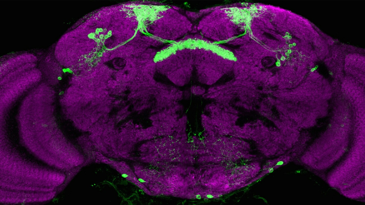 Fly brain