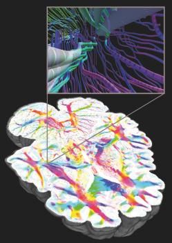 Brain Research Image