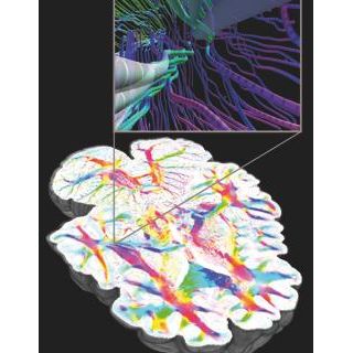 Brain Research Image