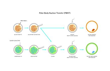 Polar Body Graphic