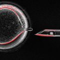 Mitochondrial replacement therapy