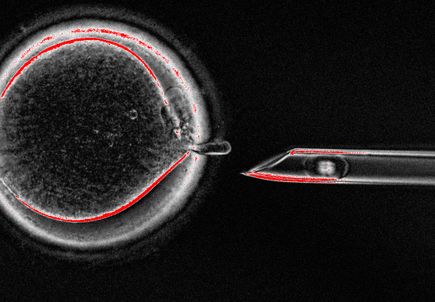 Mitochondrial replacement therapy