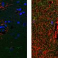 Alzheimers Cognitively Vessels