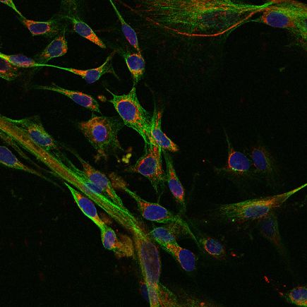 Mitochondria