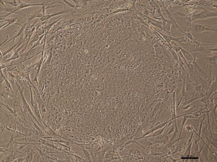 Mutant-iPSCs