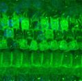 A damaged hair cell region with missing hair cells after treatment with kanamycin, in an endotxemic mouse