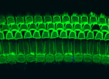 Image of the (intact) organ of Corti, with 3 rows of outer hair cells, and one row of inner hair