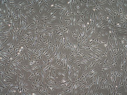 Gene therapy