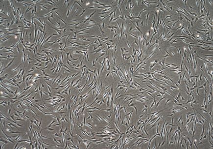 Gene therapy