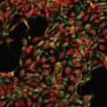 Gene therapy
