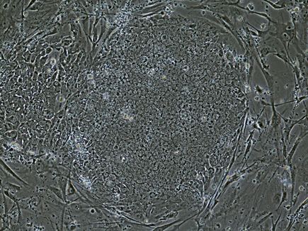 Gene therapy