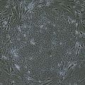 Gene therapy