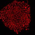 Gene therapy