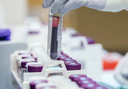 Interview with Dr. Louis Picker: Discovering a Cure for HIV/AIDS