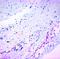 Zika research