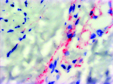 Zika research