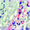 Zika research