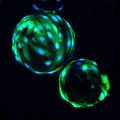 Stroke stem cell therapy
