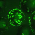 Stroke stem cell therapy