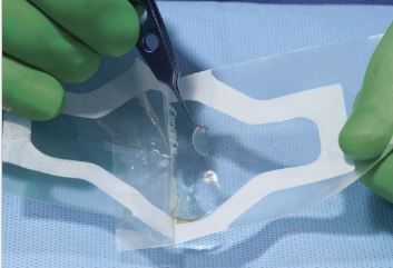 Halo graft