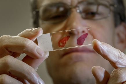 Research Week: Jeffrey Jensen, M.D., M.P.H.