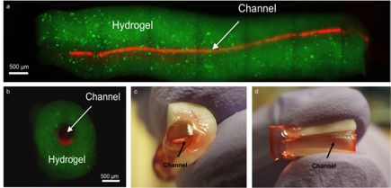 New research on root canal treatment