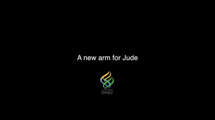 VIDEO: 3D printed prosthetic device