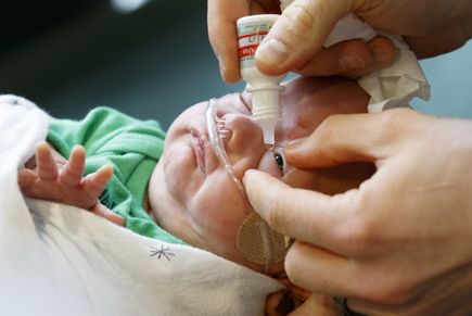 Retinopathy of prematurity (ROP)