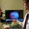 Retinopathy of prematurity (ROP)