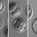 Germline editing