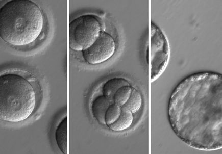 Germline editing