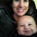 Hydrocephalus: Four days post surgery