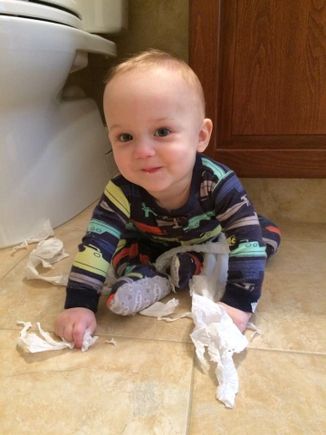 Hydrocephalus: Baby Jake