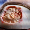Brain surgery simulator