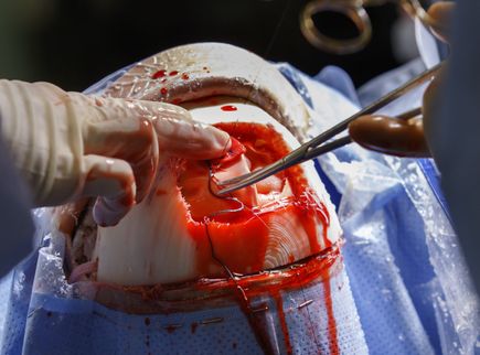 Brain surgery simulator