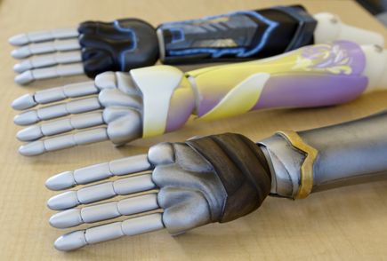 Bionic arm clinical trial
