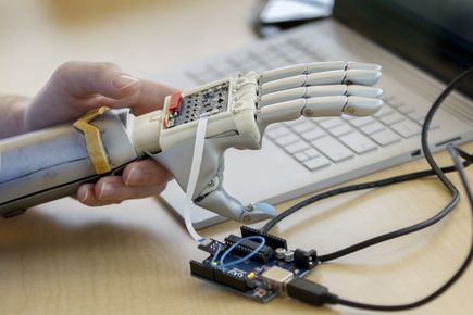Bionic arm clinical trial