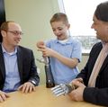 Bionic arm clinical trial