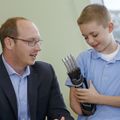 Bionic arm clinical trial