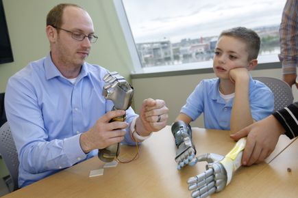 Bionic arm clinical trial