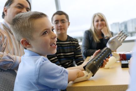 Bionic arm clinical trial