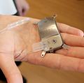 Responsive Neurostimulation System device