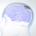 Responsive Neurostimulation System illustration