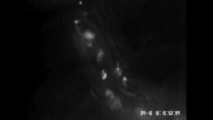 VIDEO DOWNLOAD: Cardio vein platelette