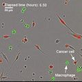 Cancer cell fusing with macrophage